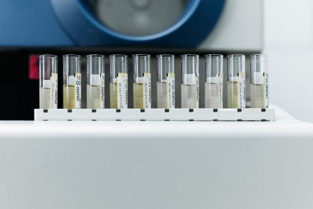 Conductivité thermique du bois : pourquoi il isole naturellement Conductivité thermique du bois : pourquoi il isole naturellement